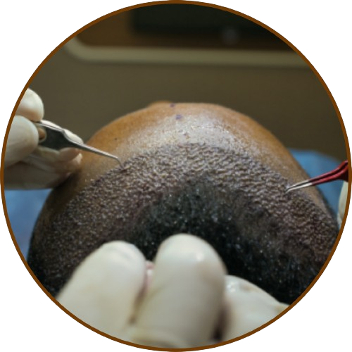 Hair Transplant & Skin Clinic