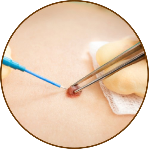 Hair Transplant & Skin Clinic